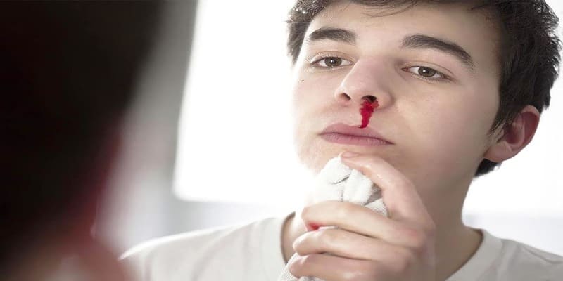 Mộng chảy máu mũi mang ý nghĩa không tốt lành